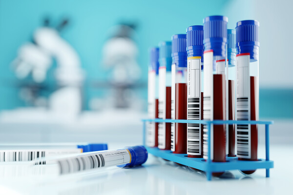 Image representing GET YOUR TEST RESULTS